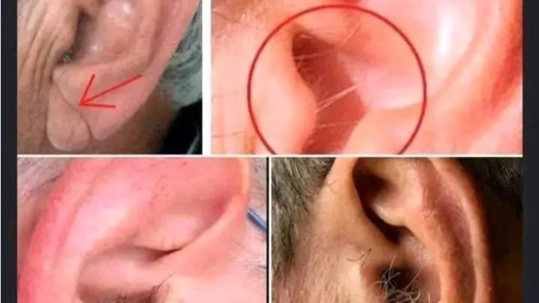 sabias que si te crecen los pelos en las orejas es por que a tu cuerpo tienen