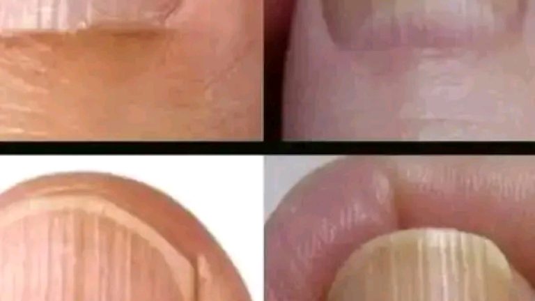 Un mes antes de un infarto, tu cuerpo te avisará estas señales
