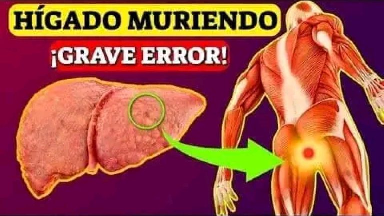 Señales Extrañas de que ya tienes DAÑO HEPATICO