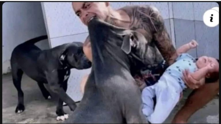 Impactante ataque de Pitbull a éste niño