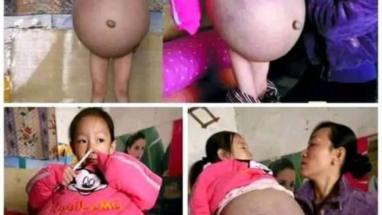 ‼La niña lloraba del dolor, su vientre crecía y le dijeron q tenía 8 meses de embarazo