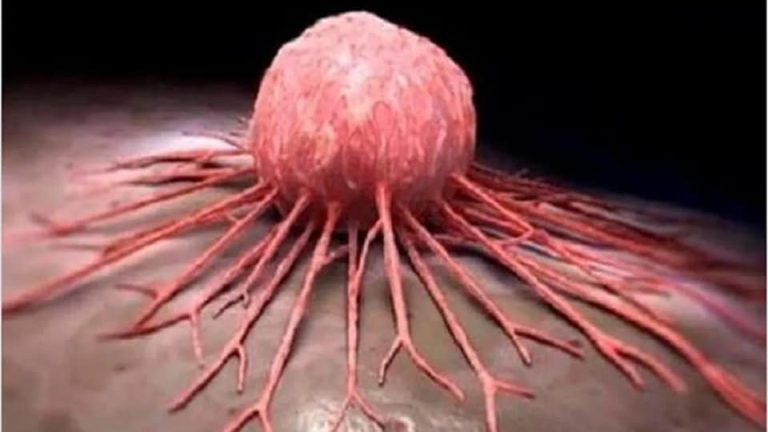 EL CÁNCER ES PRODUCIDO POR LA DEFICIENCIA DE ESTAS VITAMINAS, LOS DOCTORES LO SABEN, PERO LO TIENEN COMO UN NEGOCIO.
