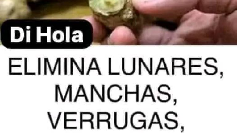 La verrugas y manchas del cuerpo se caen como